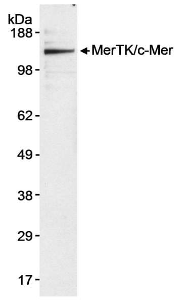 MER / MERTK Antibody (aa200-250)