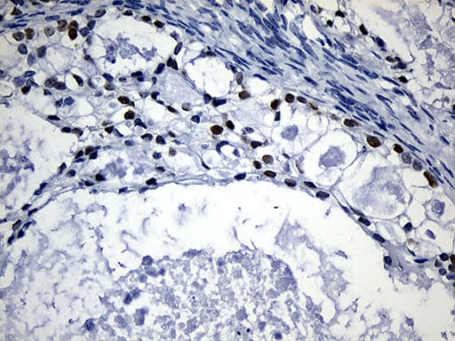 HOXD8 Antibody (aa69-290, clone OTI2A1)