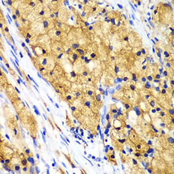 CAPG Antibody