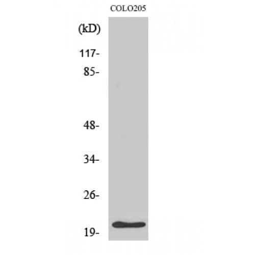 CDKN1A / WAF1 / p21 Antibody (80-160 aa)