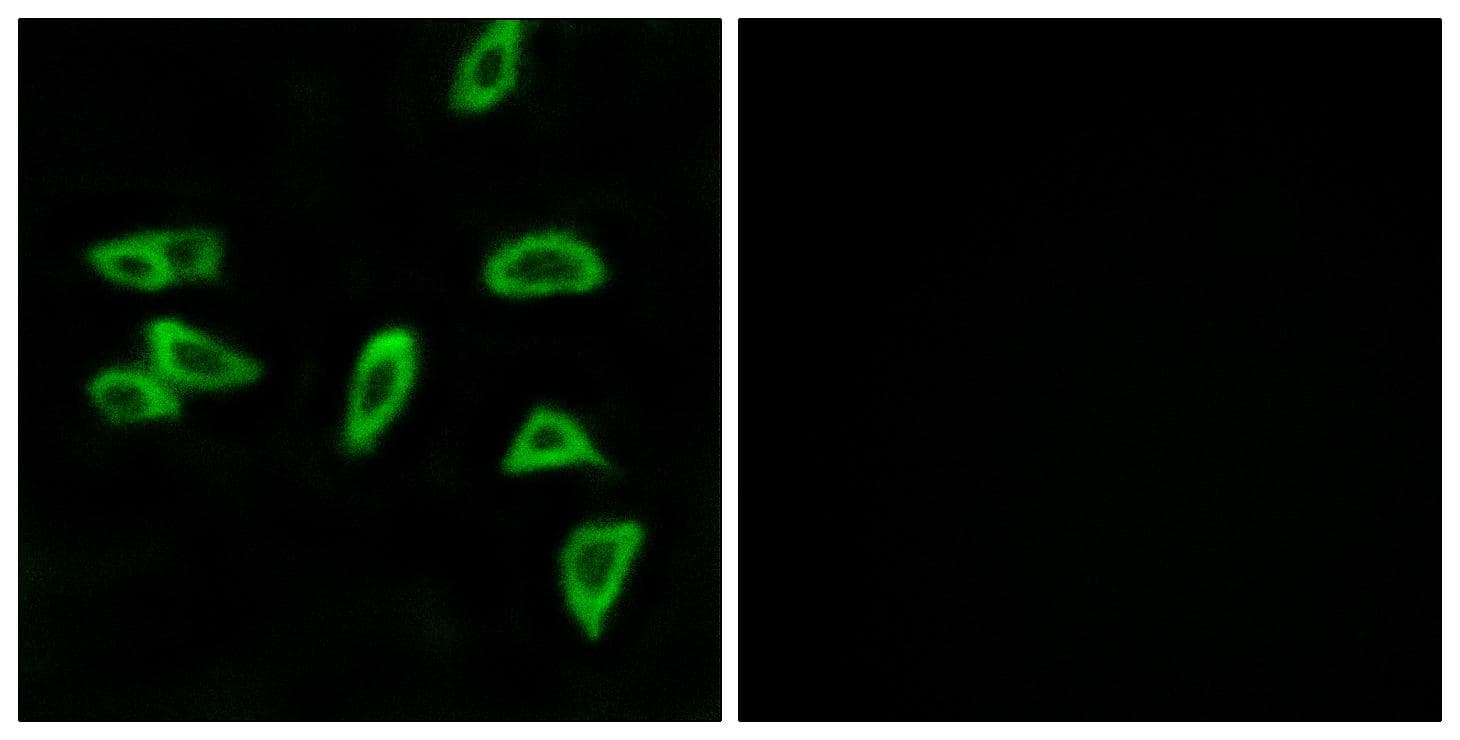 PTGER3 / EP3 Antibody