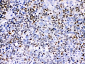 IKZF1 / IKAROS Antibody
