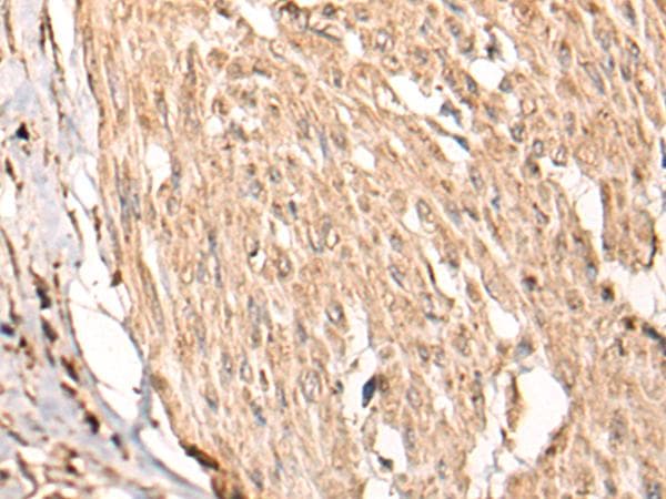 HSF4 Antibody