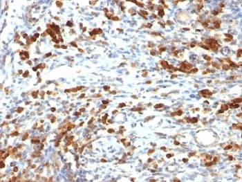 CD79A / CD79 Alpha Antibody (clone IGA/764)