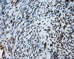 Monoclonal Mouse anti-Human ACLY / ATP Citrate Lyase Antibody (clone 3G8, Carrier-free, IHC, IF, WB)