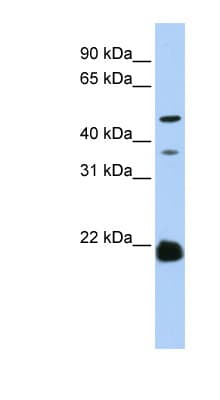 ZDHHC14 Antibody (aa108-157)
