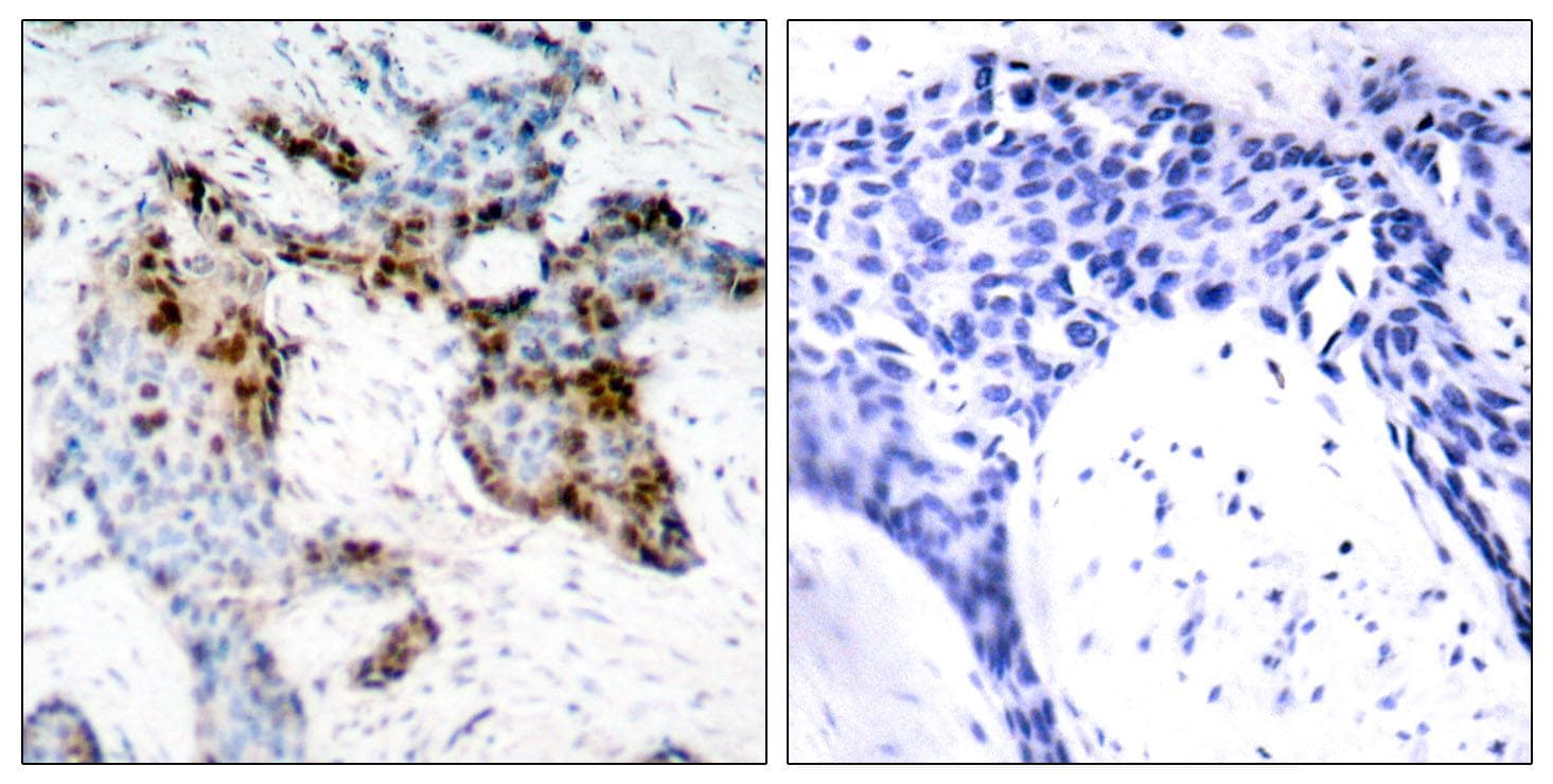 ER Alpha / Estrogen Receptor Antibody (p118)