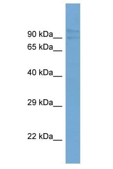 Zfy2 Antibody (aa151-200)