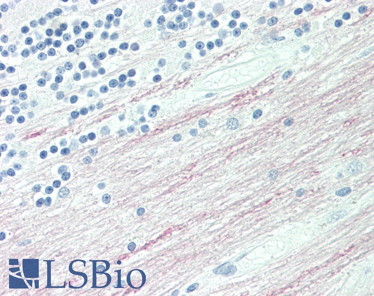 IHC-plus™ Polyclonal Rabbit anti-Human CPT1C Antibody (aa752-782, IHC, WB)