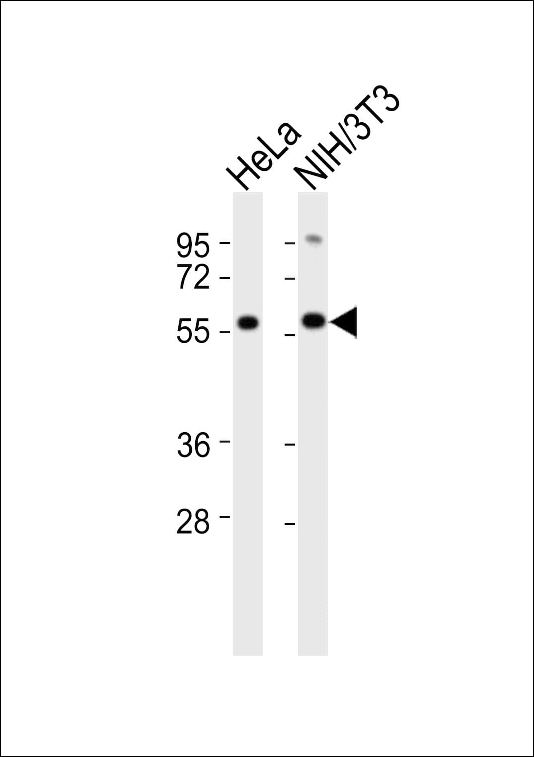 KLF11 Antibody