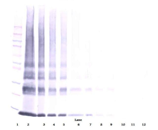IHC-plus™ Polyclonal Rabbit anti-Human LGALS1 / Galectin 1 Antibody (IHC, WB)