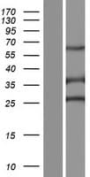 SPEF2 Protein (Over-Expression Lysate Myc-DDK (Flag))