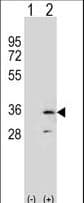 RPA2 / RFA2 / RPA34 Antibody (aa66-96)