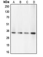 CASP7 / Caspase 7 Antibody (N-Terminus)