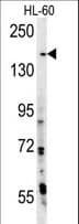 PHLPP2 / PHLPPL Antibody (aa4-31)