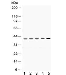 OSM / Oncostatin M Antibody