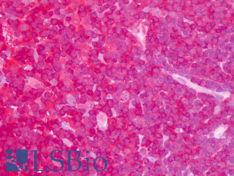 IHC-plus™ Polyclonal Rabbit anti-Human ARHGDIA / RHOGDI Antibody (IHC, WB)