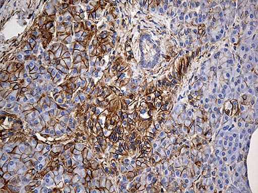 SPTAN1 / Alpha Fodrin Antibody (aa1-147, clone OTI9C10)