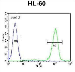 ADA / Adenosine Deaminase Antibody (aa287-314)