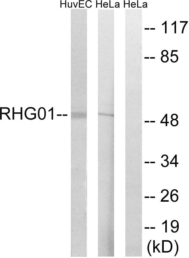 ARHGAP1 / CDC42GAP Antibody
