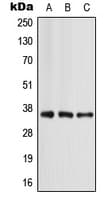 APOE / Apolipoprotein E Antibody (Internal)