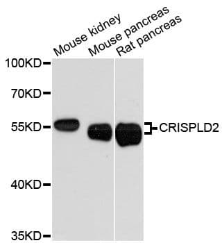 CRISPLD2 Antibody
