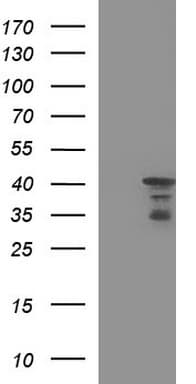 HERPUD1 / HERP Antibody (clone OTI1A2)