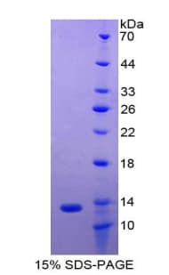 Rat PIGR Protein (Recombinant His)
