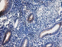 DLD / Diaphorase / E3 Antibody (clone OTI6D5)