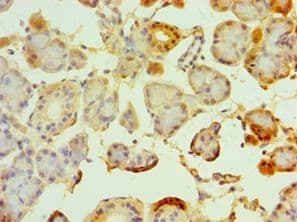 TRPM2 Antibody (aa1204-1503)