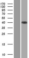 STRAP / MAWD Protein (Over-Expression Lysate Myc-DDK (Flag))
