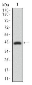 Monoclonal Mouse anti-Human DNM1L / DRP1 Antibody (clone 4E11B11, aa100-250, IHC, WB)