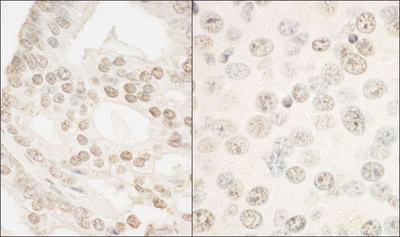 Polyclonal Rabbit anti-Human FOXP1 Antibody (aa627-677, IHC, WB)