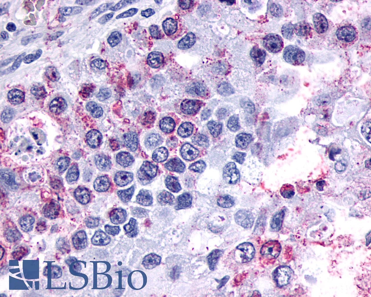 PathPlus™ Polyclonal Rabbit anti-Human GPR3 Antibody (Extracellular Domain, IHC, IF)