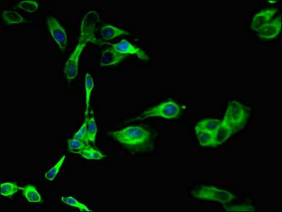 SGK1 / SGK Antibody