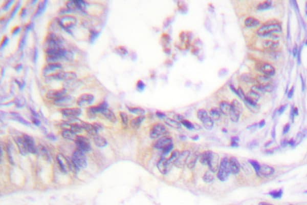 PAK1 Antibody (Ile206)
