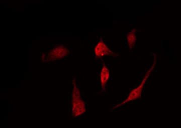 AKT1 Antibody (phospho-Ser473)
