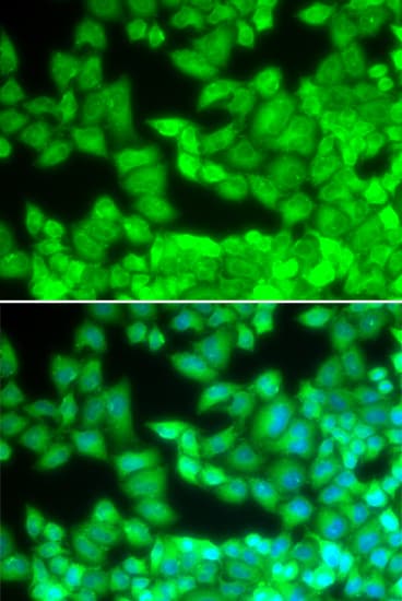 CD40L Antibody