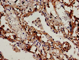 BCL2L11 / BIM Antibody
