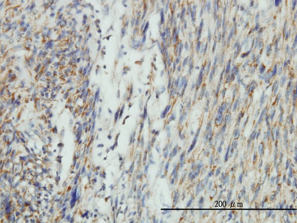 Monoclonal Mouse anti-Human DNM1L / DRP1 Antibody (clone 3B5, IHC, WB)
