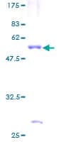 Human C4BPB / C4BP Beta Protein (Recombinant GST)