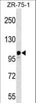 Polyclonal Rabbit anti-Human STK31 Antibody (aa987-1018, IHC, WB)