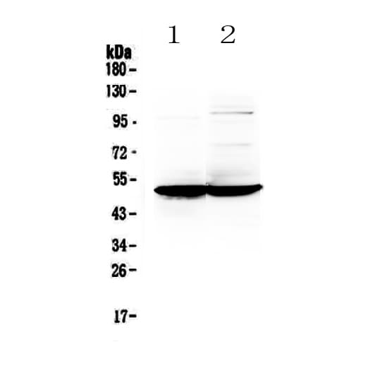 GFAP Antibody
