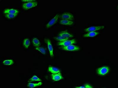 Polyclonal Rabbit anti-Human ATL2 Antibody (IHC, WB)