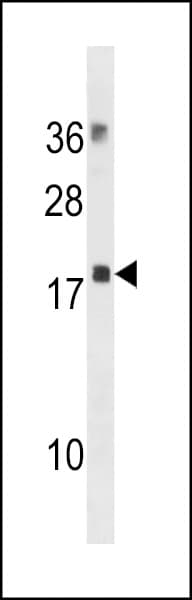 MRLC2 / MYL12B Antibody (aa1-30)