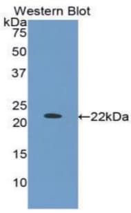 IGFBP1 Antibody (aa112-263)