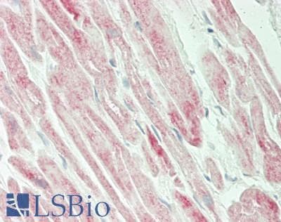 IHC-plus™ Polyclonal Rabbit anti-Human SLC25A11 Antibody (Internal, IHC, WB)
