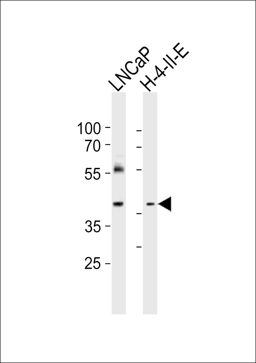 RING1 Antibody (aa279-313)