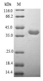 Human CHRNA3 Protein (Recombinant 10His-SUMO, N-terminus + Myc, C-terminus)