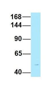 Polyclonal Rabbit anti-Human EPHA7 / EPH Receptor A7 Antibody (aa841-890, WB)